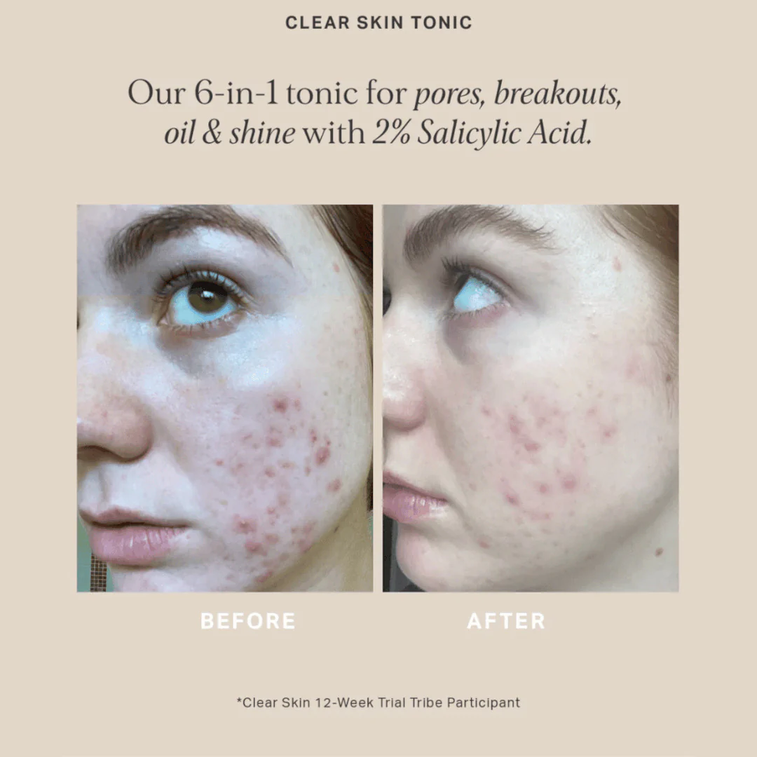 Alpha-H Clear Skin Tonic - Image 3