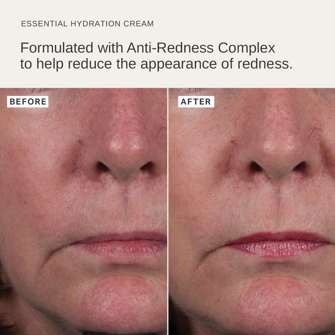 Alpha-H Essential Hydration Cream with Rose Geranium - Image 3