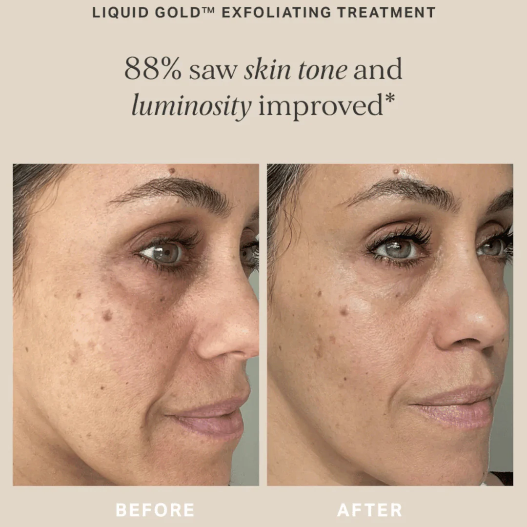 Alpha-H Liquid Gold Exfoliating Treatment with 5% Glycolic Acid - Image 4