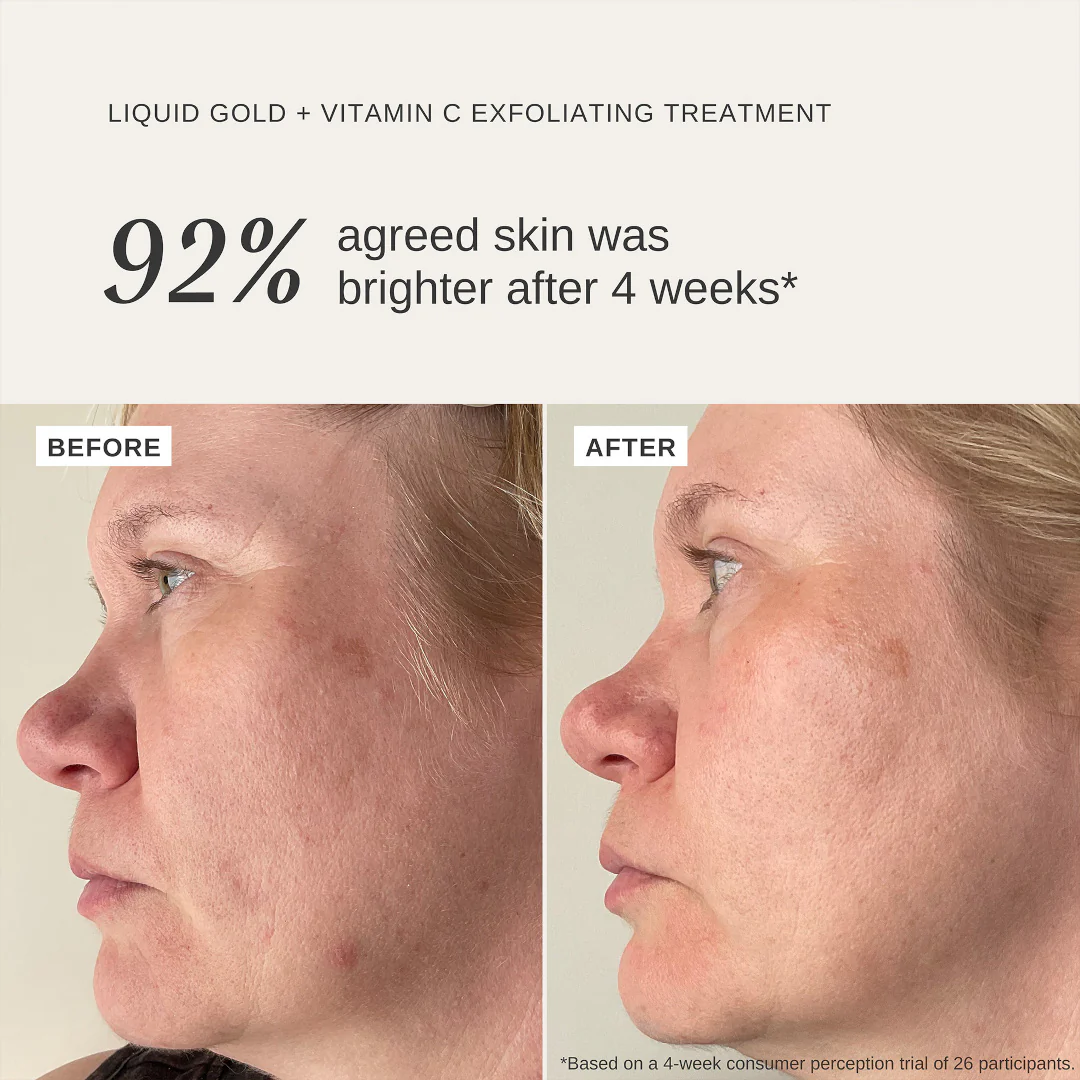 Alpha-H Liquid Gold Exfoliating Treatment with Vitamin C - Image 3