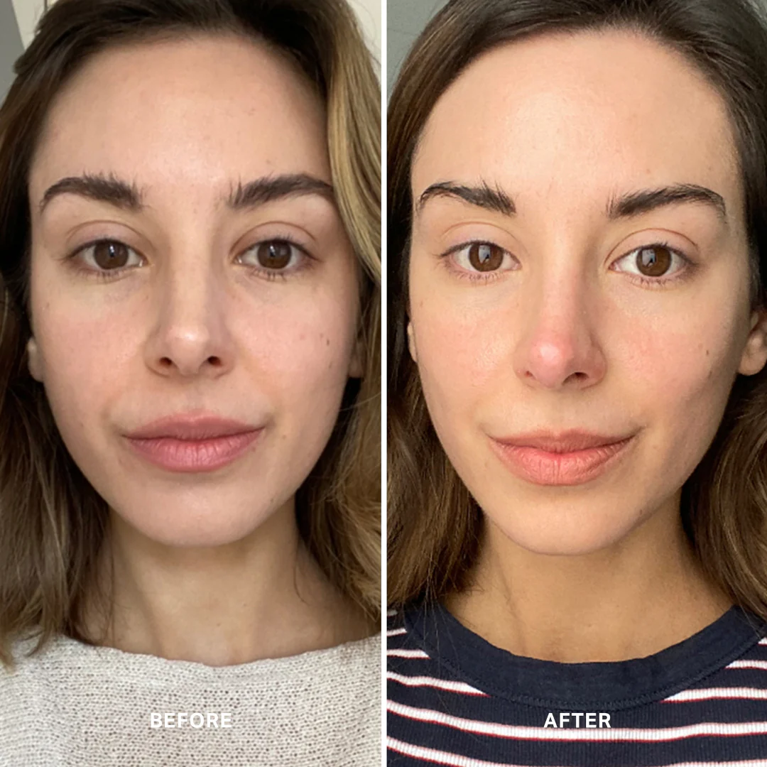 Alpha-H Vitamin C Serum with 10% Ethyl Ascorbic Acid - Image 4
