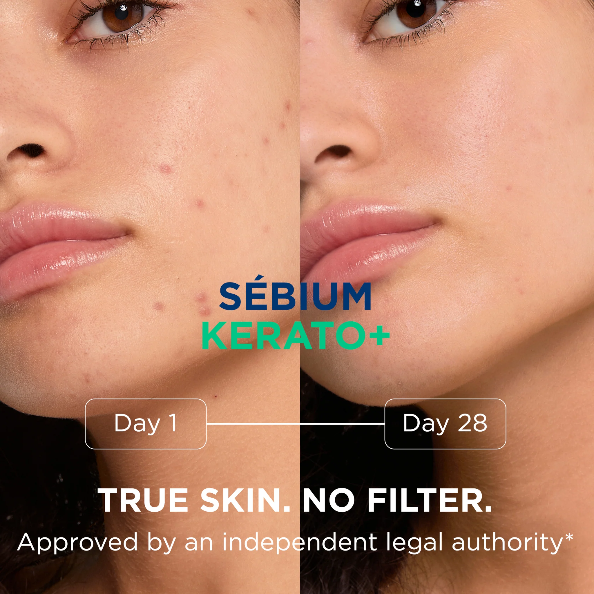 Bioderma Sebium Kerato + Anti Blemish High Tolerance Gel-Cream - Image 3