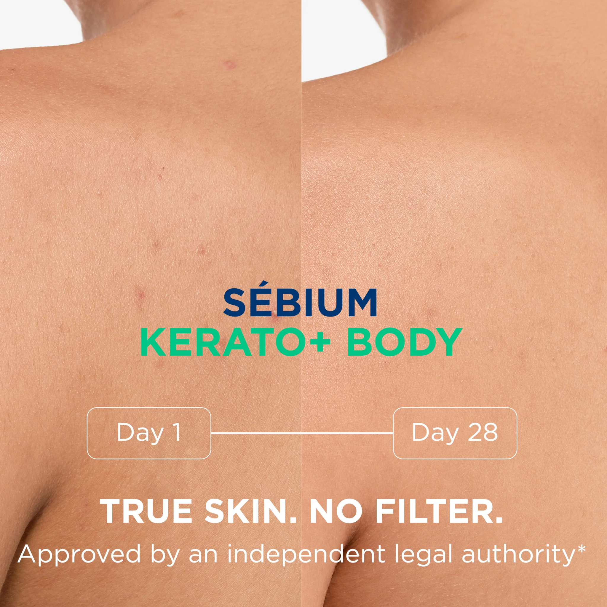 Bioderma Sebium Kerato+ Body Anti Blemish Spray - Image 3