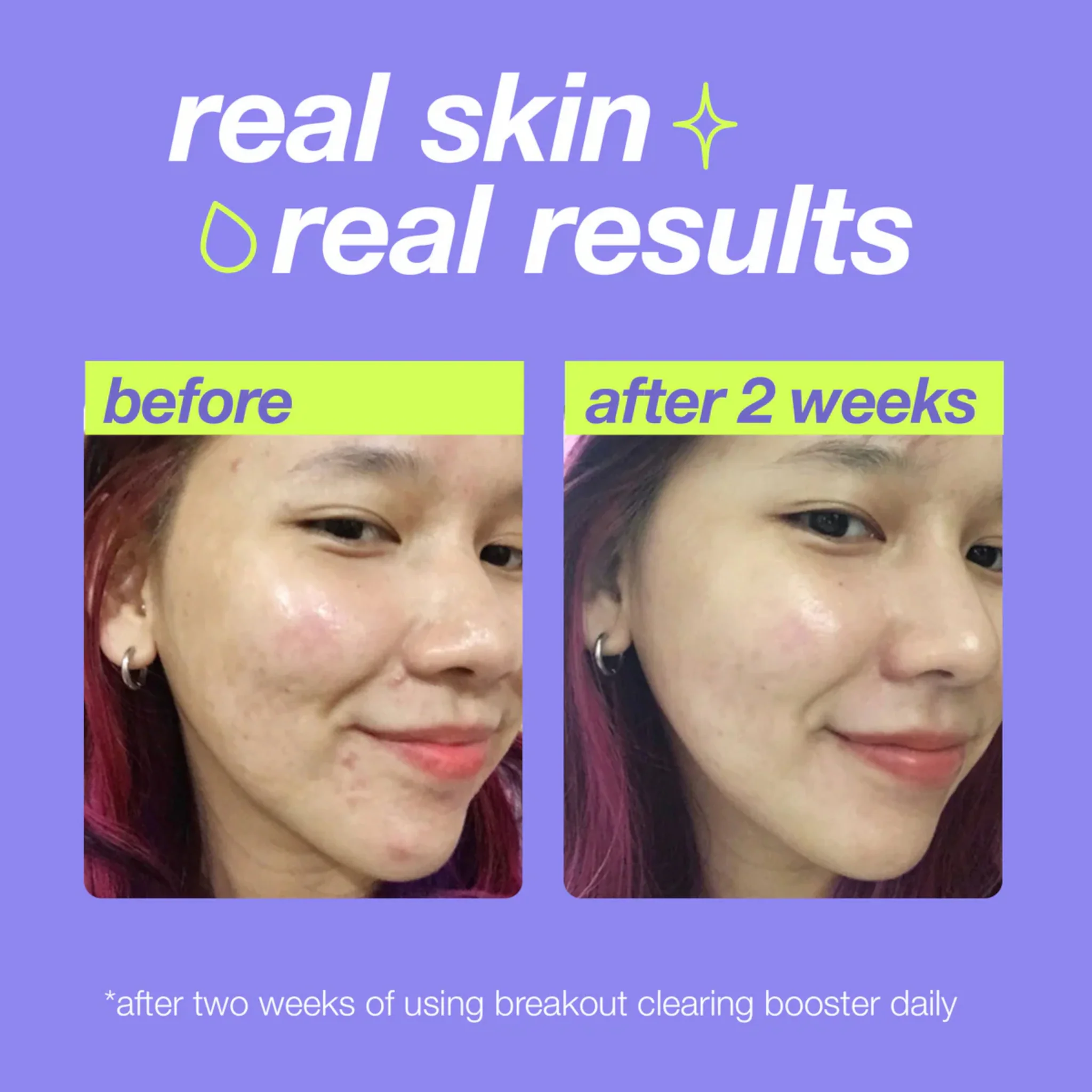 Dermalogica Clear Start Breakout Clearing Booster - Image 5