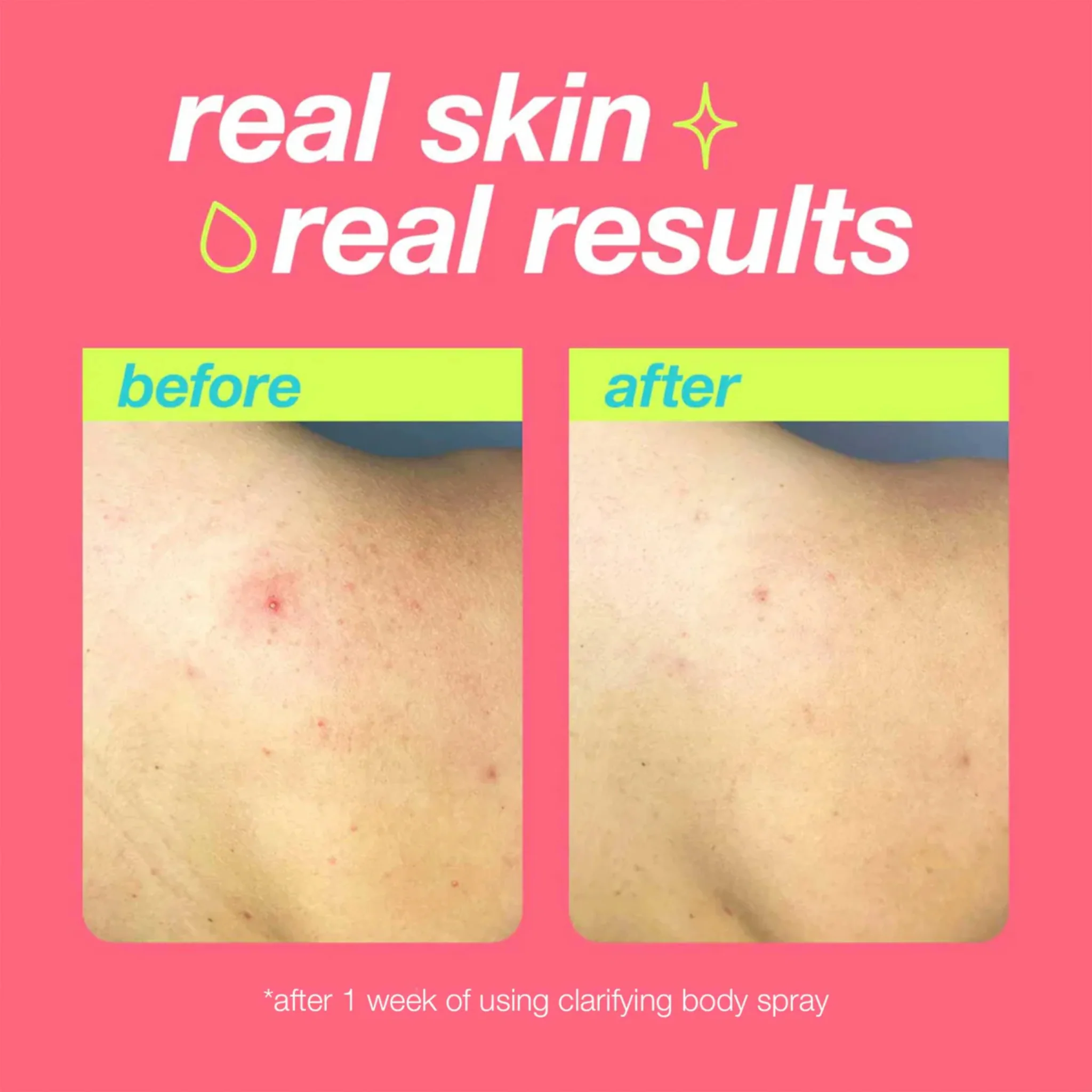 Dermalogica Clear Start Clarifying Body Spray - Image 2