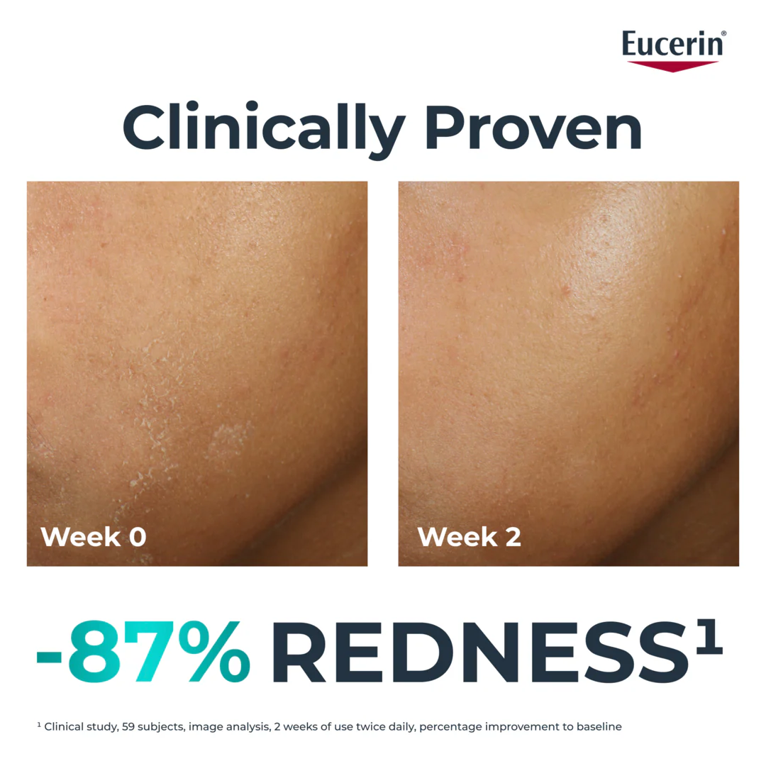 Eucerin Dermopure Hydra Repair Soothing Cream - Image 6