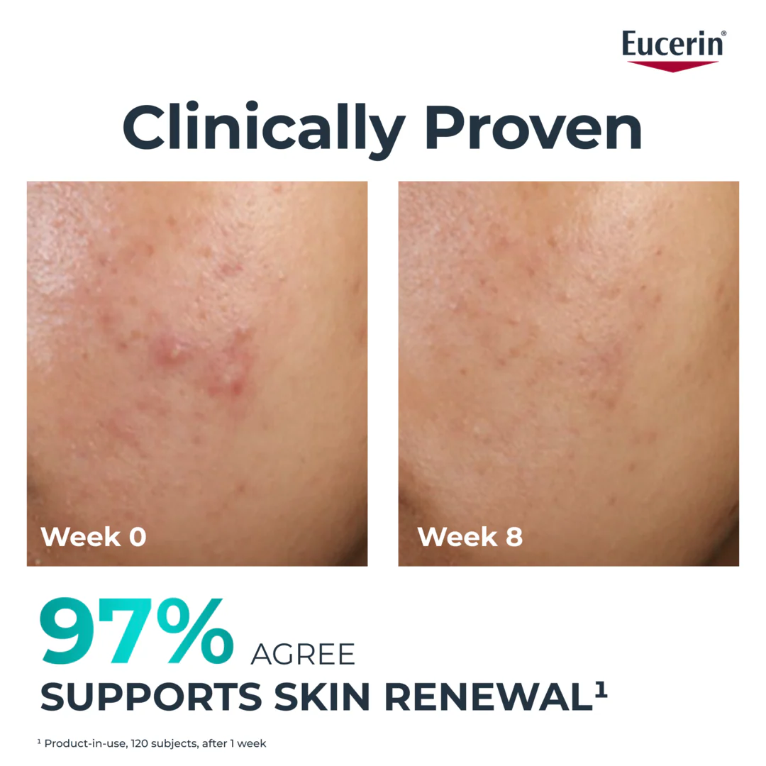 Eucerin Dermopure Peeling 10 Night Treatment - Image 5