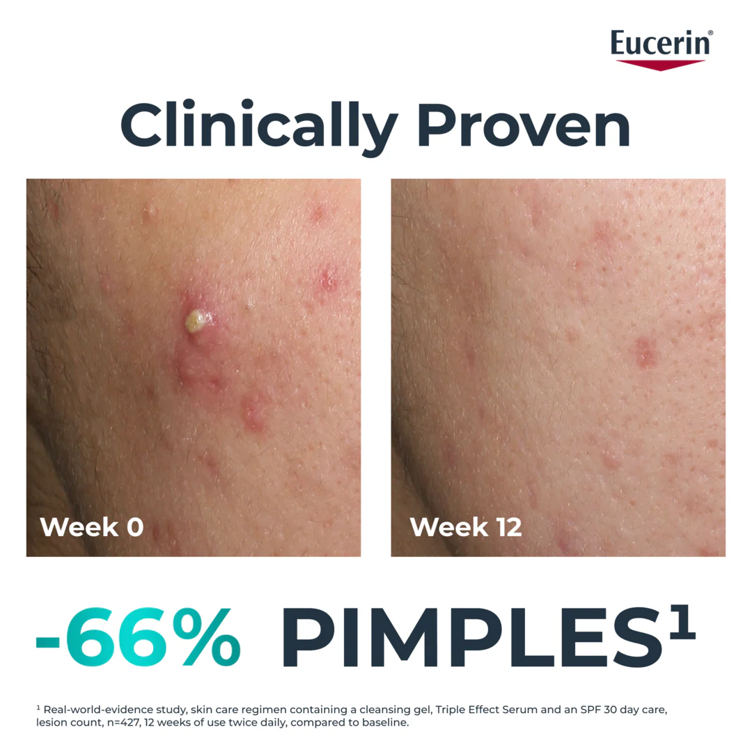 Eucerin Dermopure Triple Action Serum - Image 4