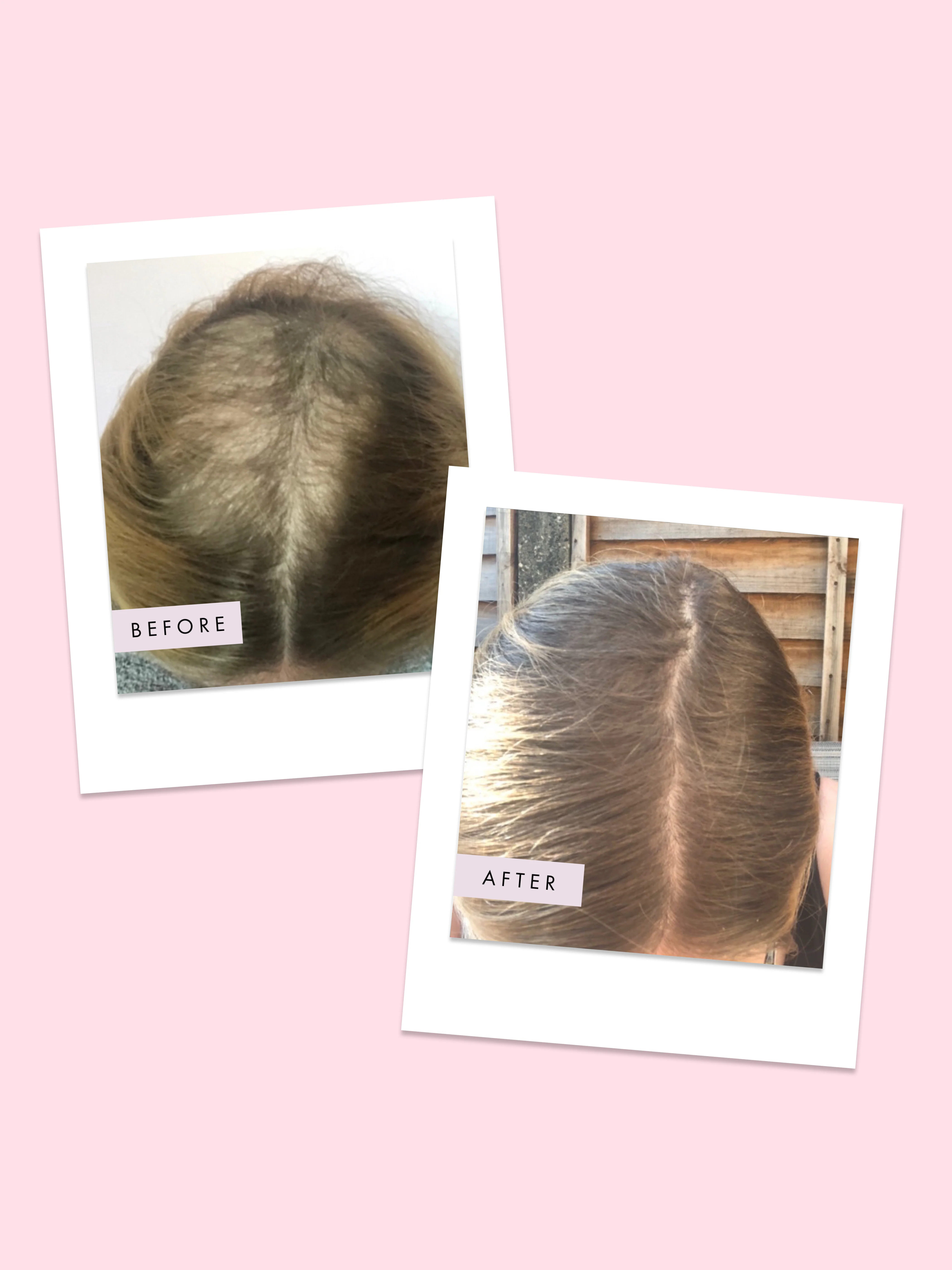 Hair Gain Hair Capsules - Image 4