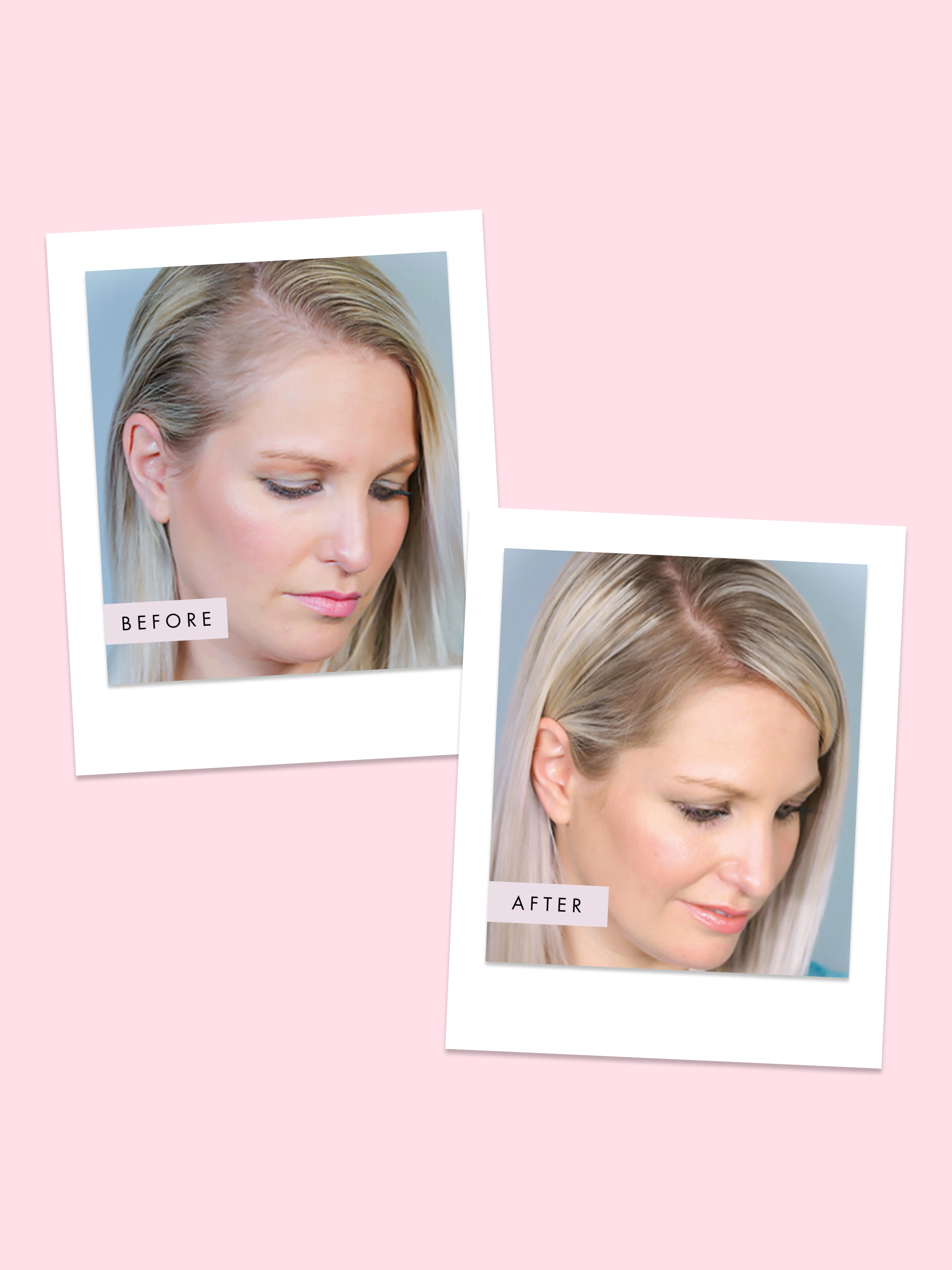 Hair Gain Hair Capsules Duo Set - Image 5