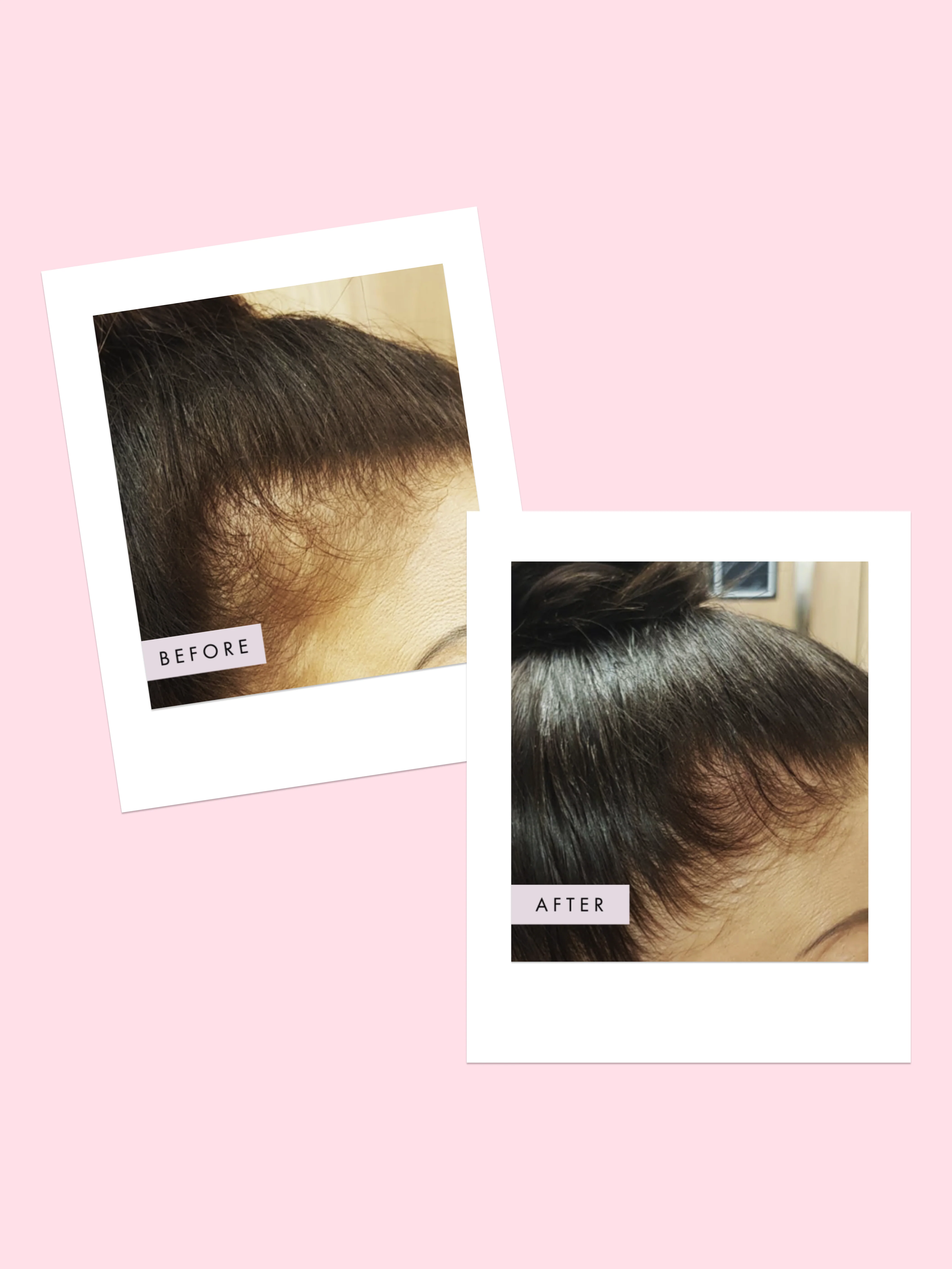 Hair Gain Hair Mask - Image 10