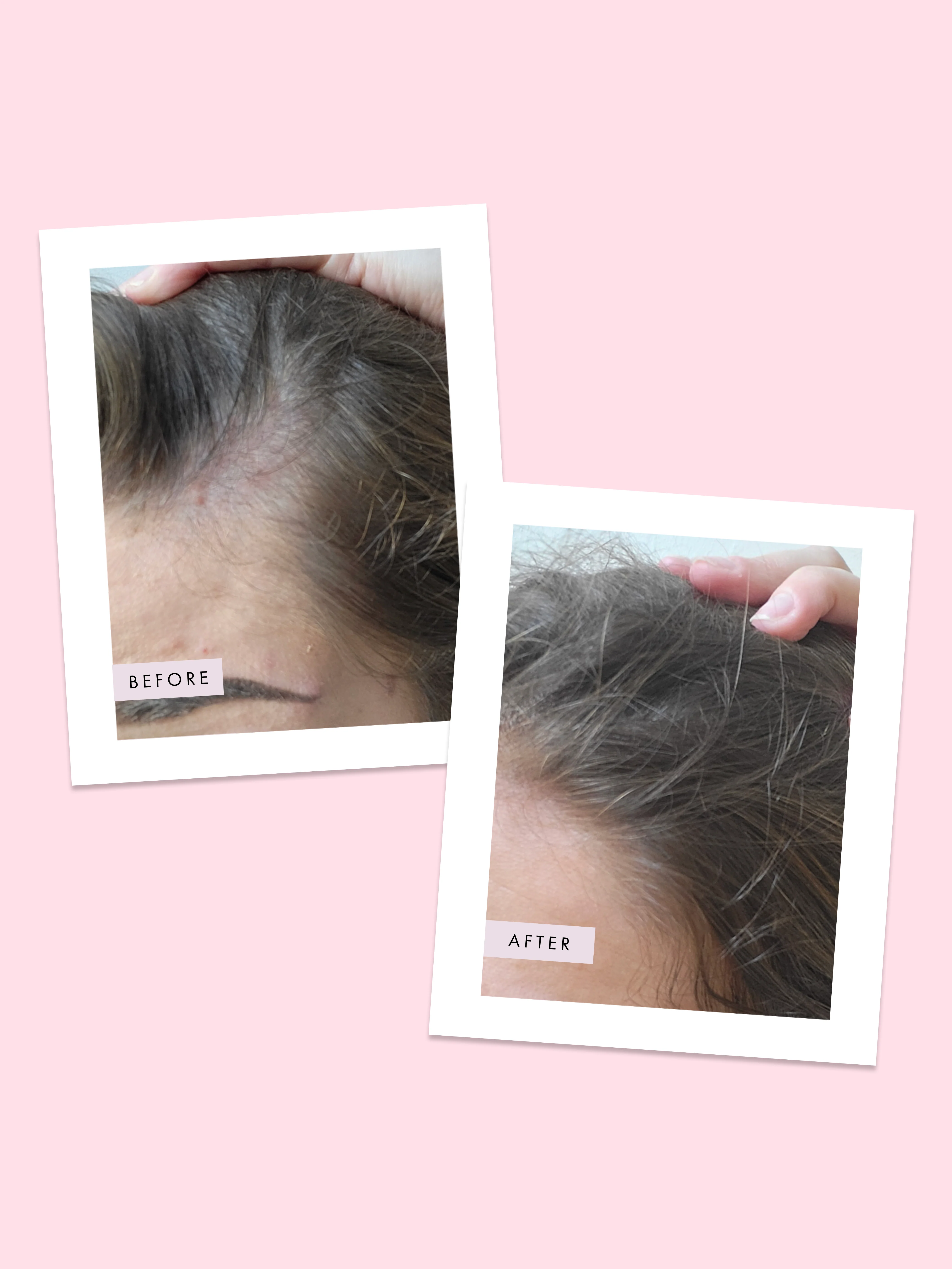 Hair Gain Scalp Foam - Image 6