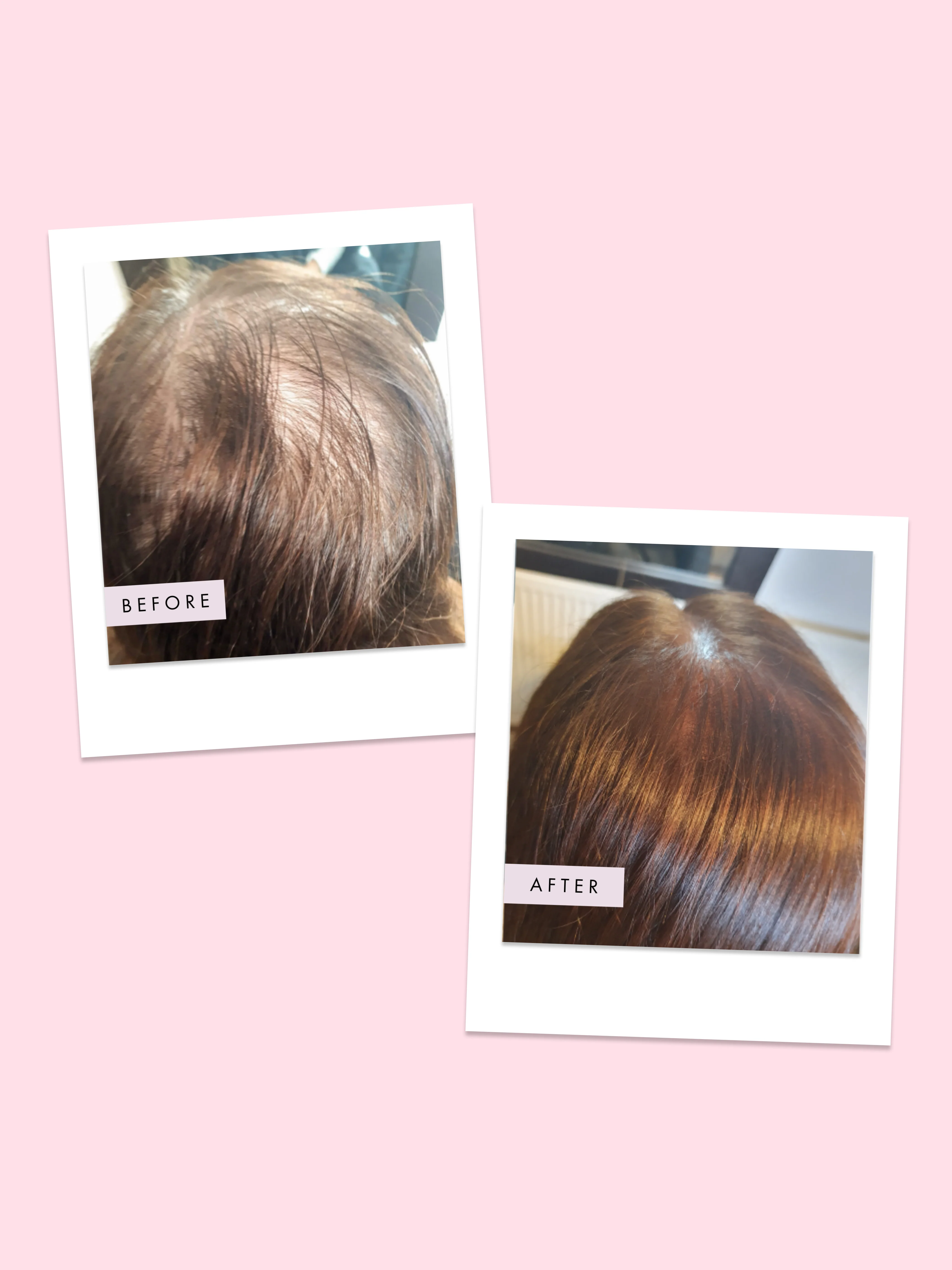 Hair Gain Vegan Hair Gummies x 60 - Image 6