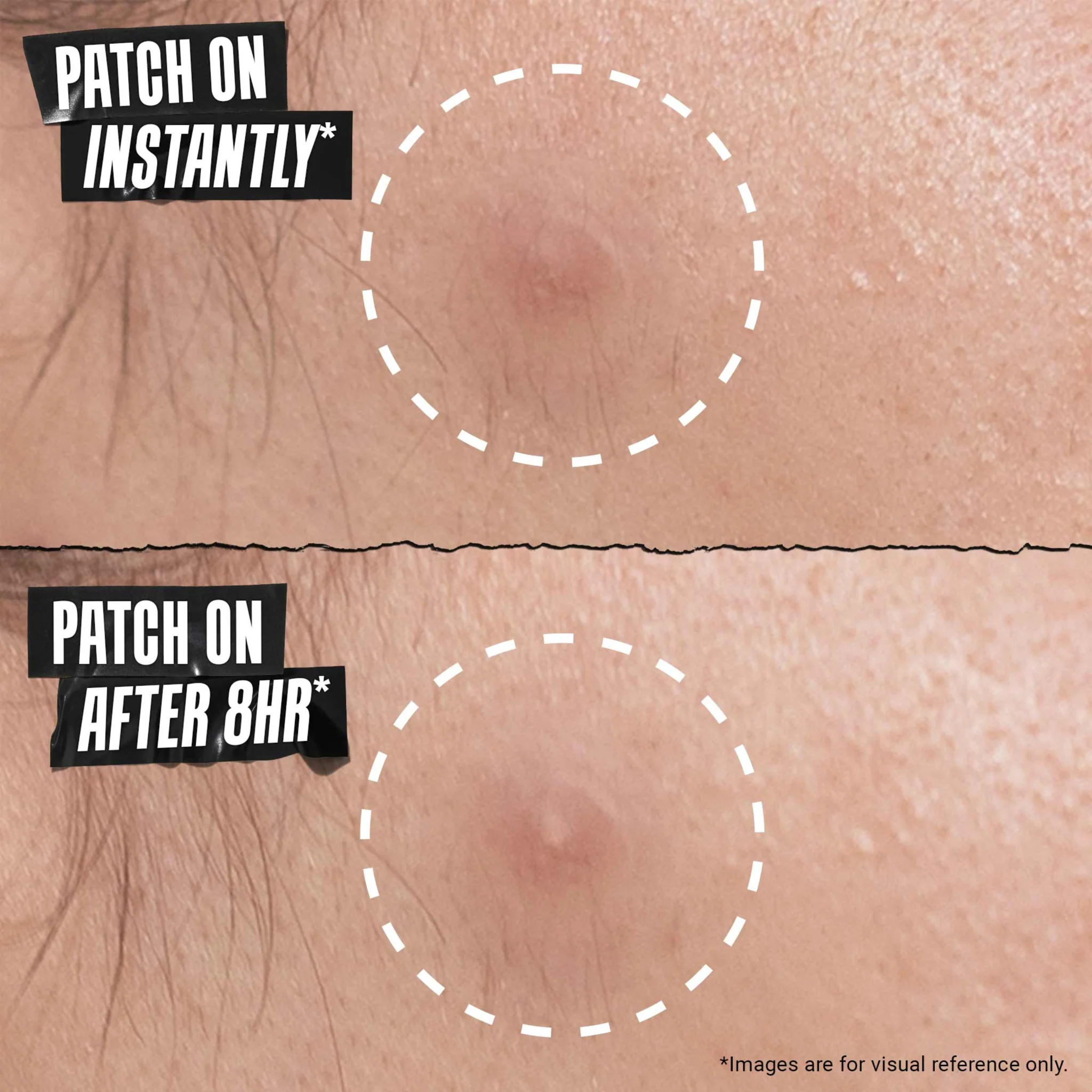 Kiehl's Truly Targeted Overnight Blemish Patch - Image 5