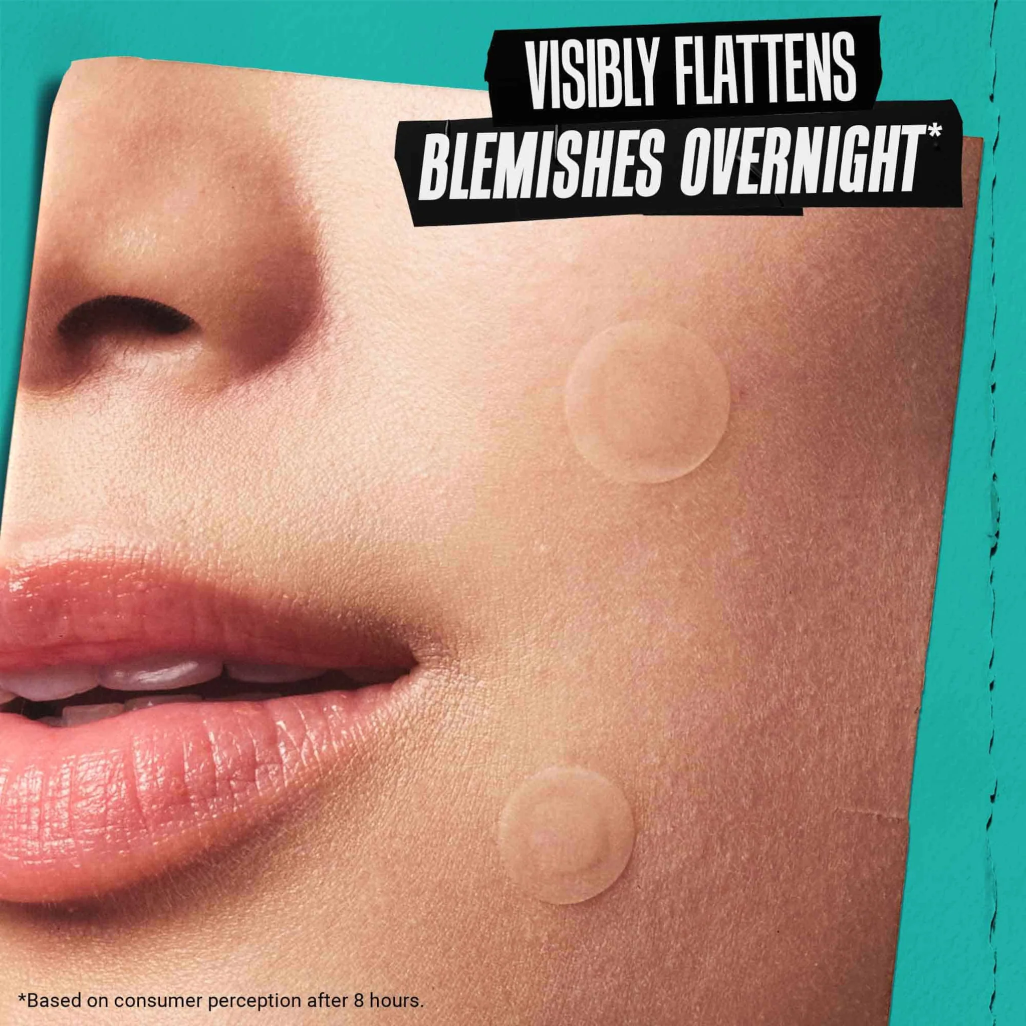 Kiehl's Truly Targeted Overnight Blemish Patch - Image 6