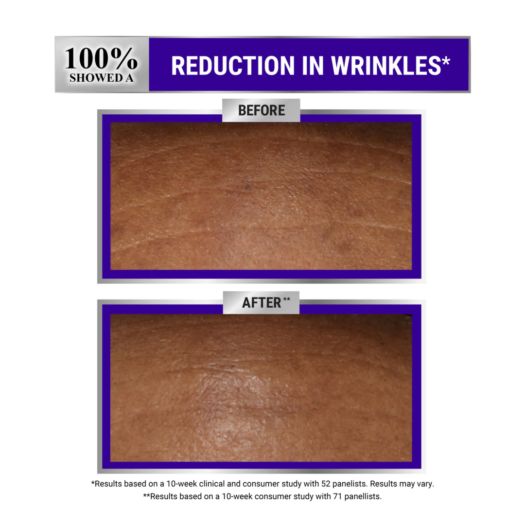 Kiehl's Retinol Skin-Renewing Daily Micro-Dose Serum - Image 5
