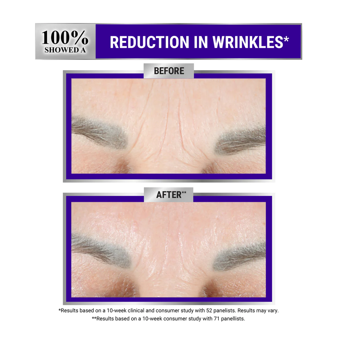 Kiehl's Retinol Skin-Renewing Daily Micro-Dose Serum - Image 6