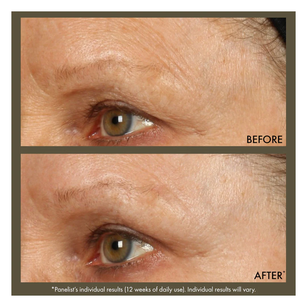 Origins Plantscription Active Wrinkle Correction Serum - Image 5