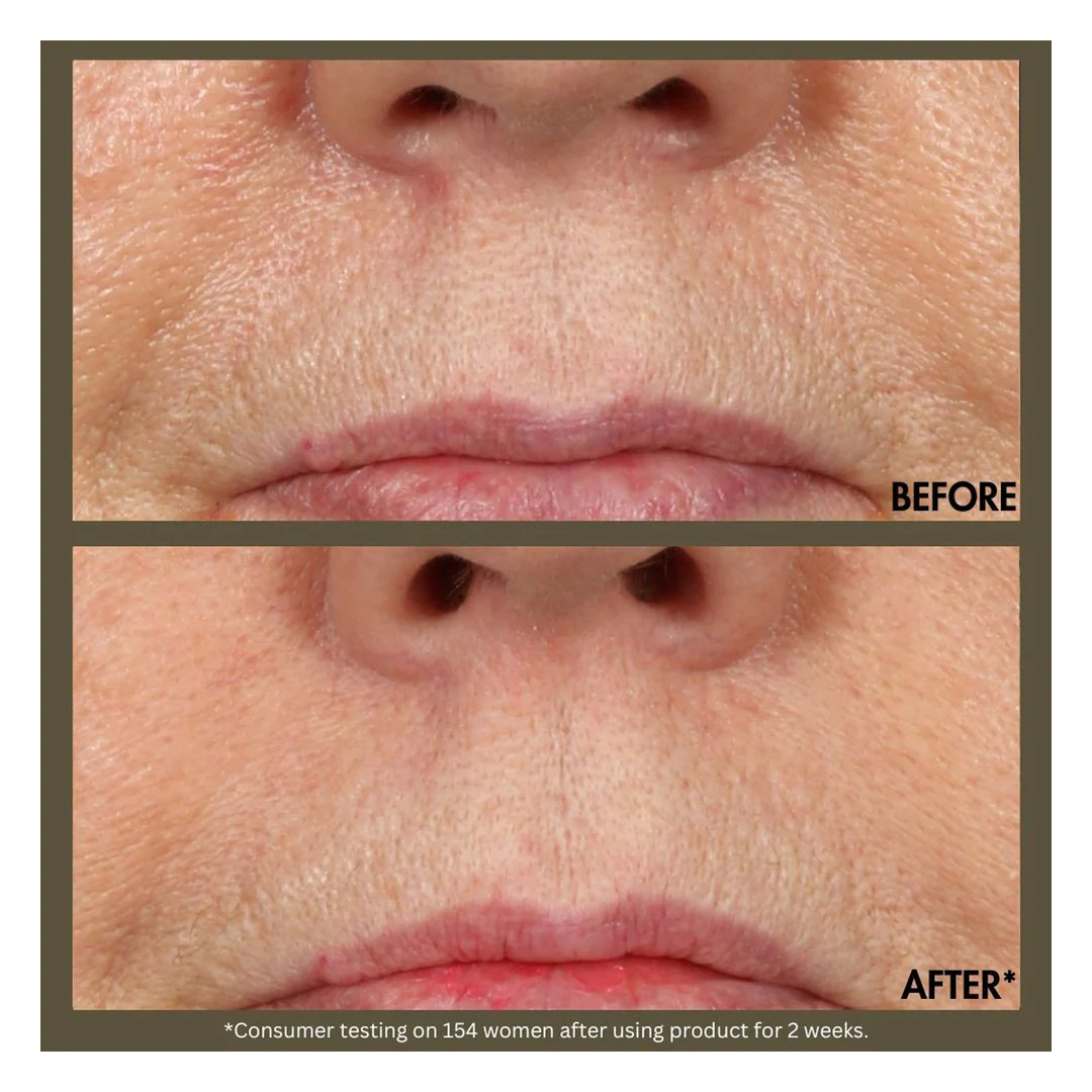 Origins Plantscription Active Wrinkle Correction Serum - Image 6