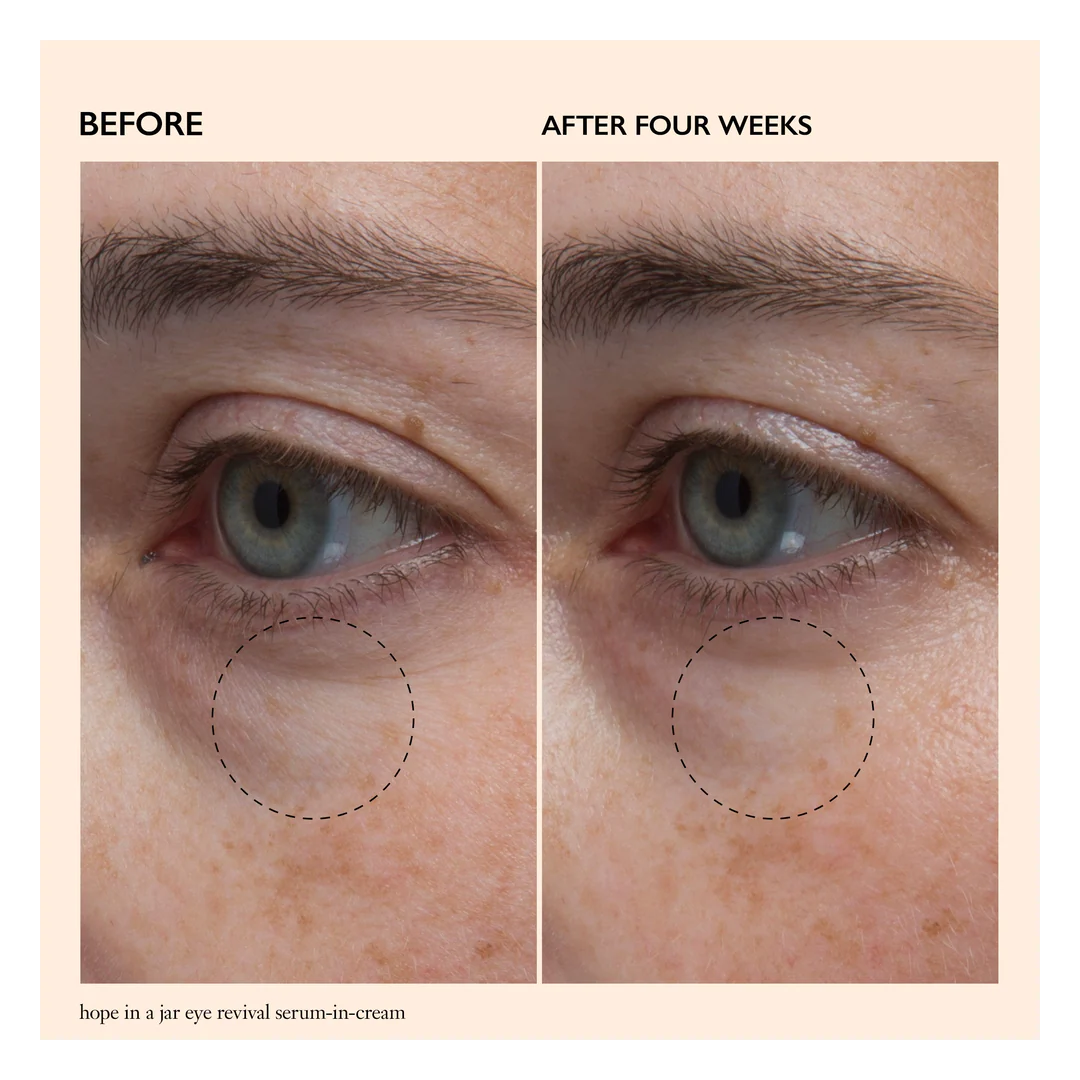 Philosophy Hope In A Jar Eye Revival Serum-in-Cream - Image 2