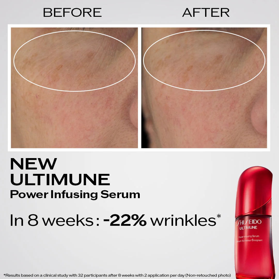 Shiseido Ultimune Power Infusing Serum - Image 8
