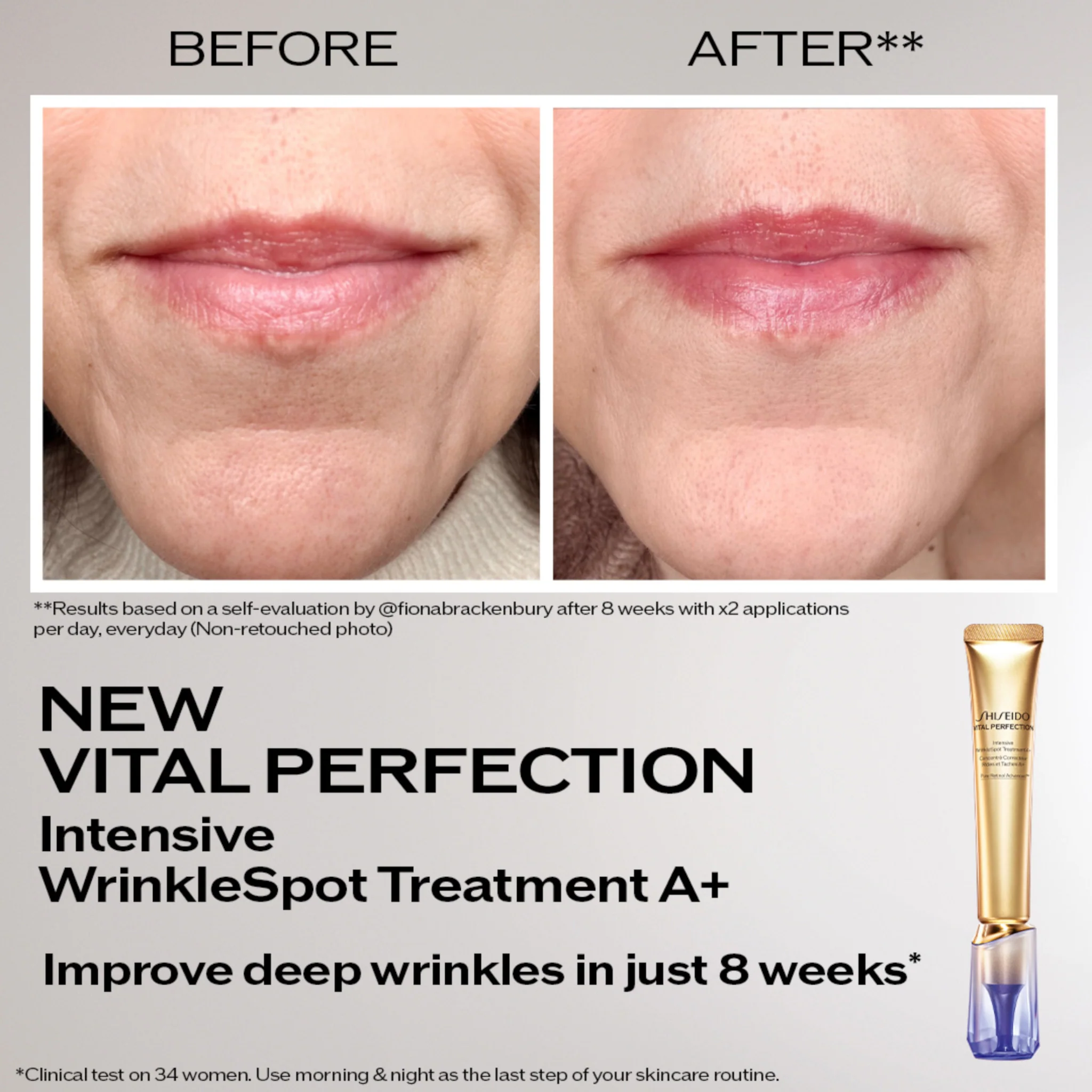 Shiseido Vital Perfection Intensive WrinkleSpot Treatment A+ - Image 2