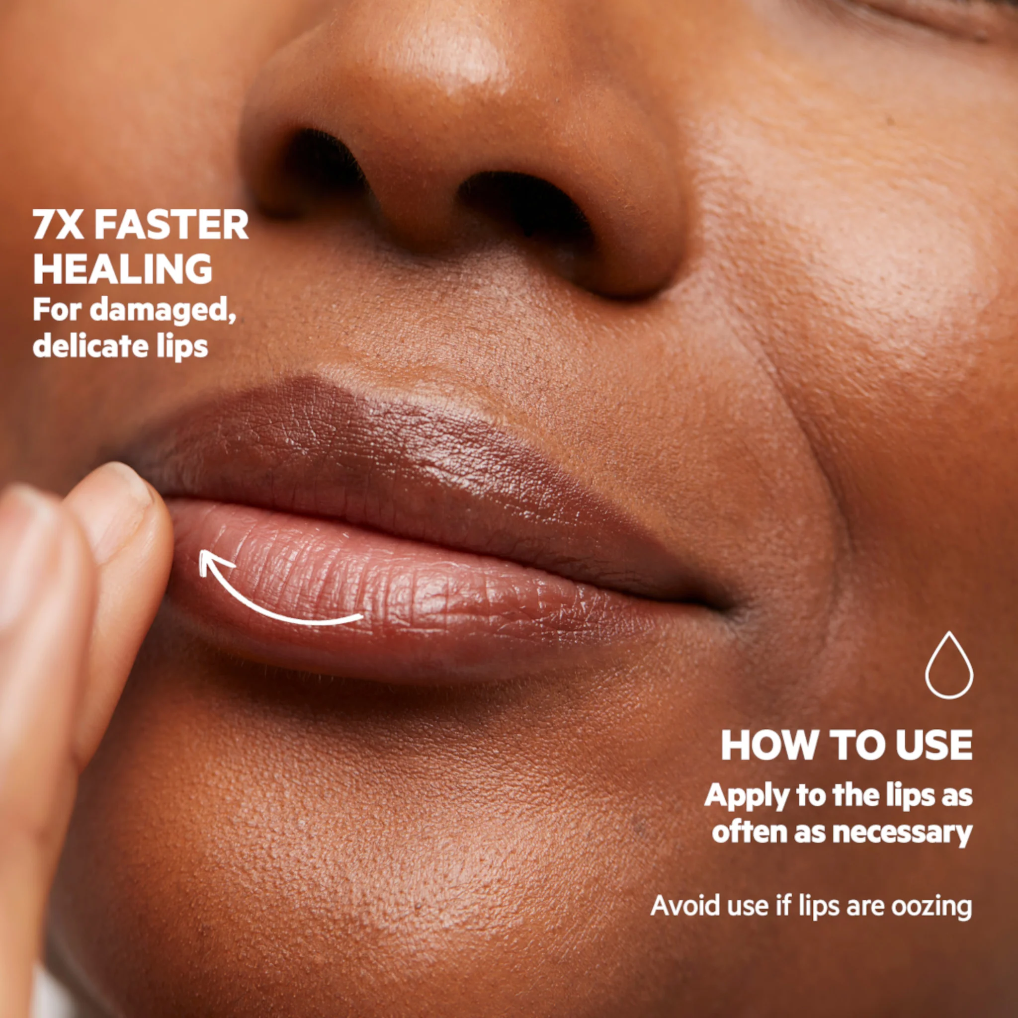 SVR Cicavit+ Lip Balm - Image 4