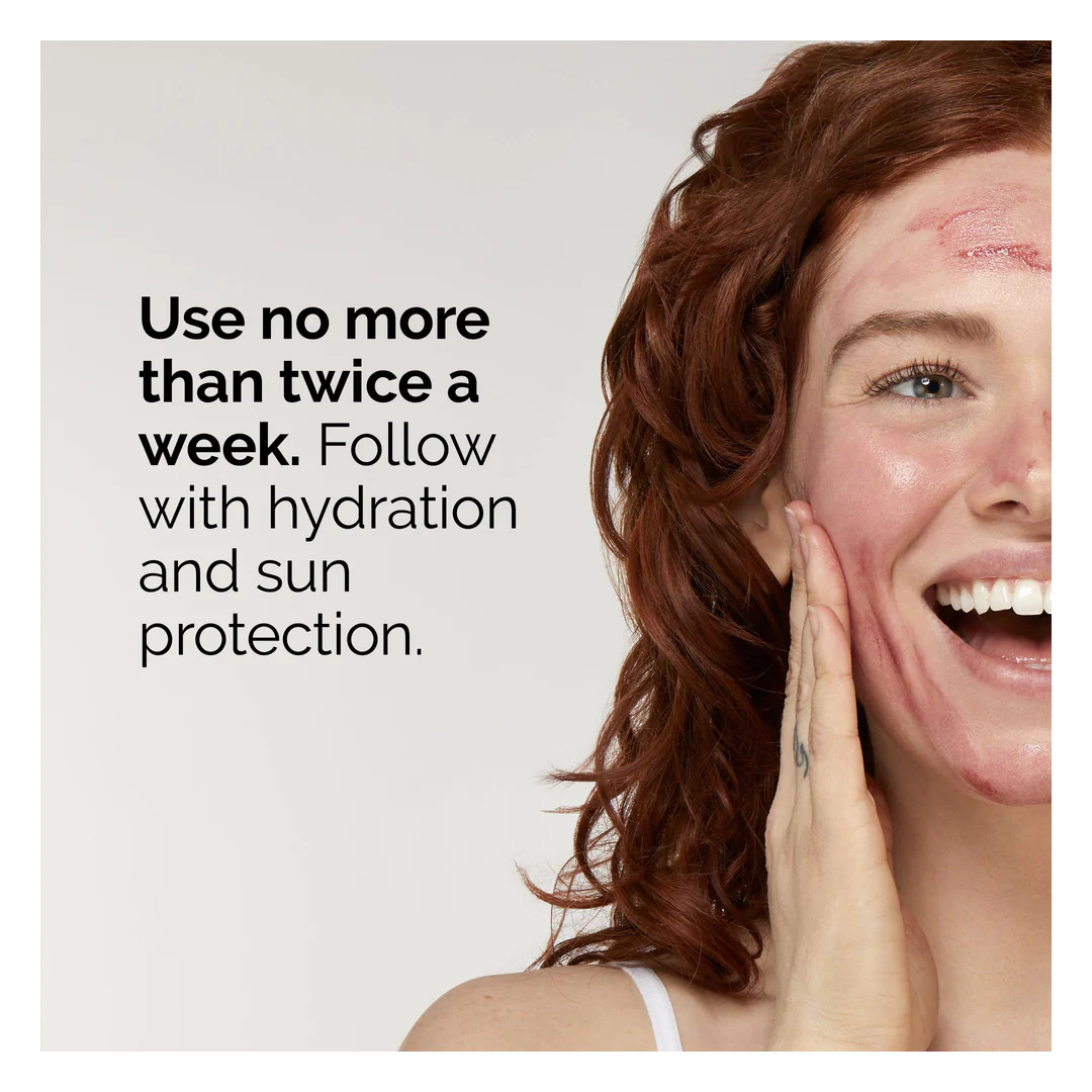 The Ordinary AHA 30% + BHA 2% Peeling Solution - Image 5