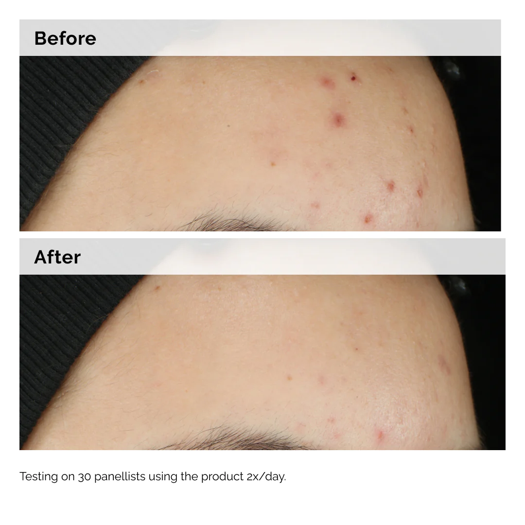 The Ordinary Balancing & Clarifying Serum - Image 2