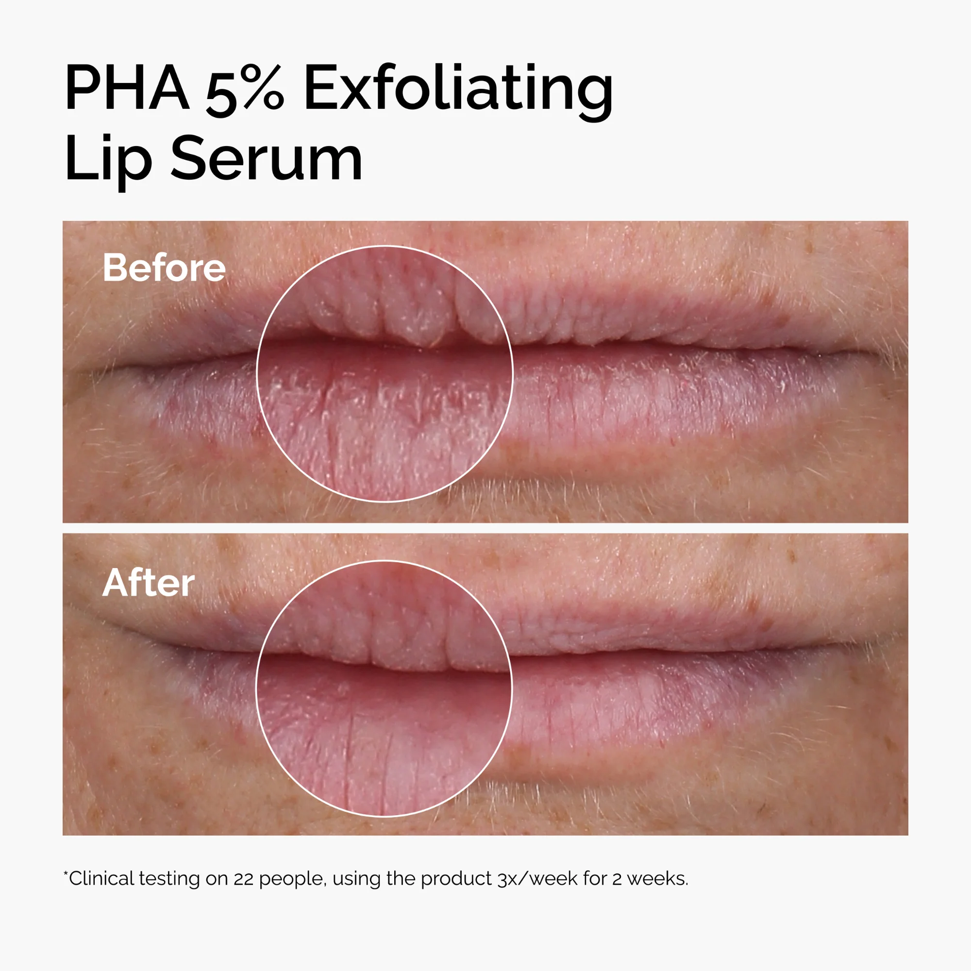 The Ordinary PHA 5% Exfoliating Lip Serum - Image 3