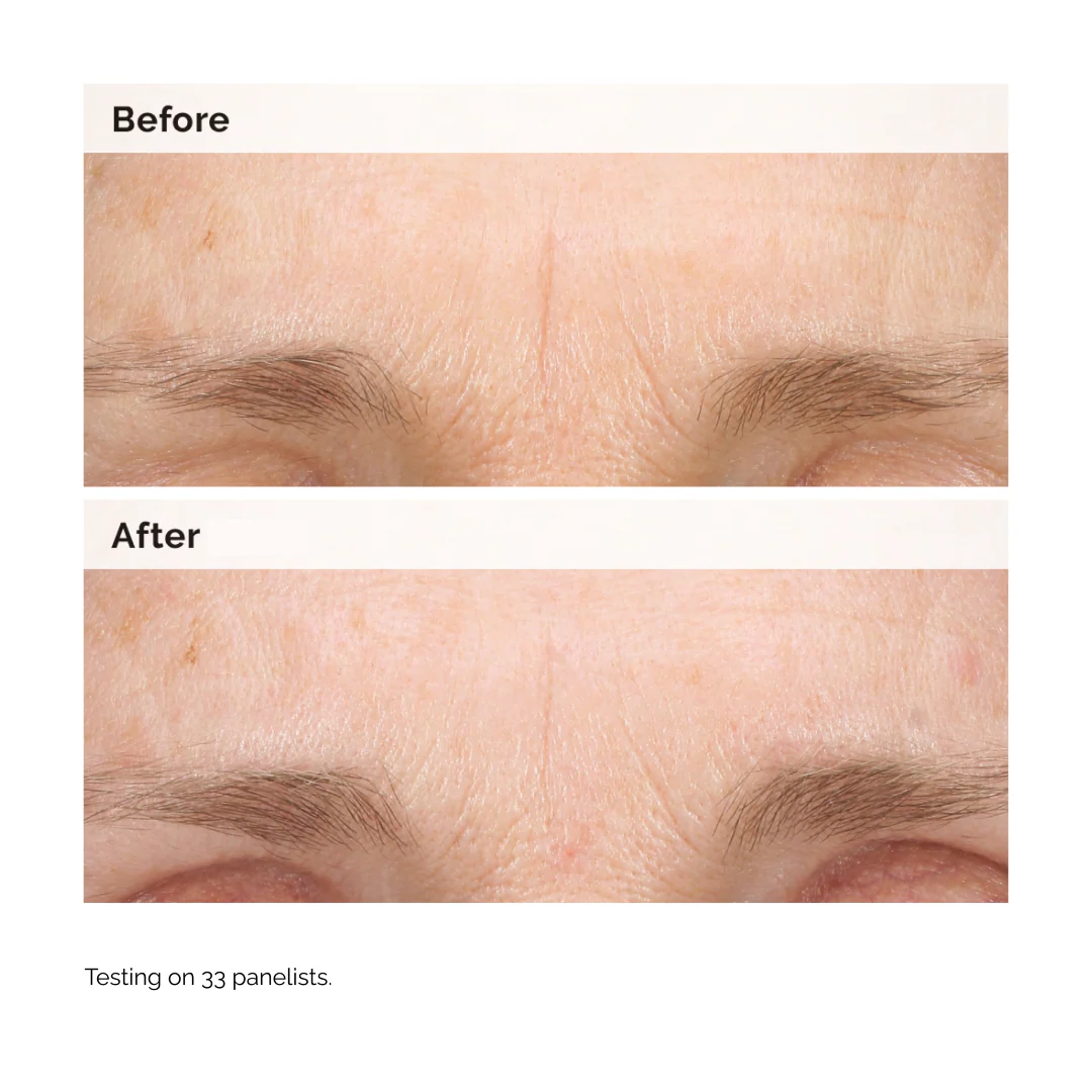 The Ordinary Retinal 0.2% Emulsion - Image 3