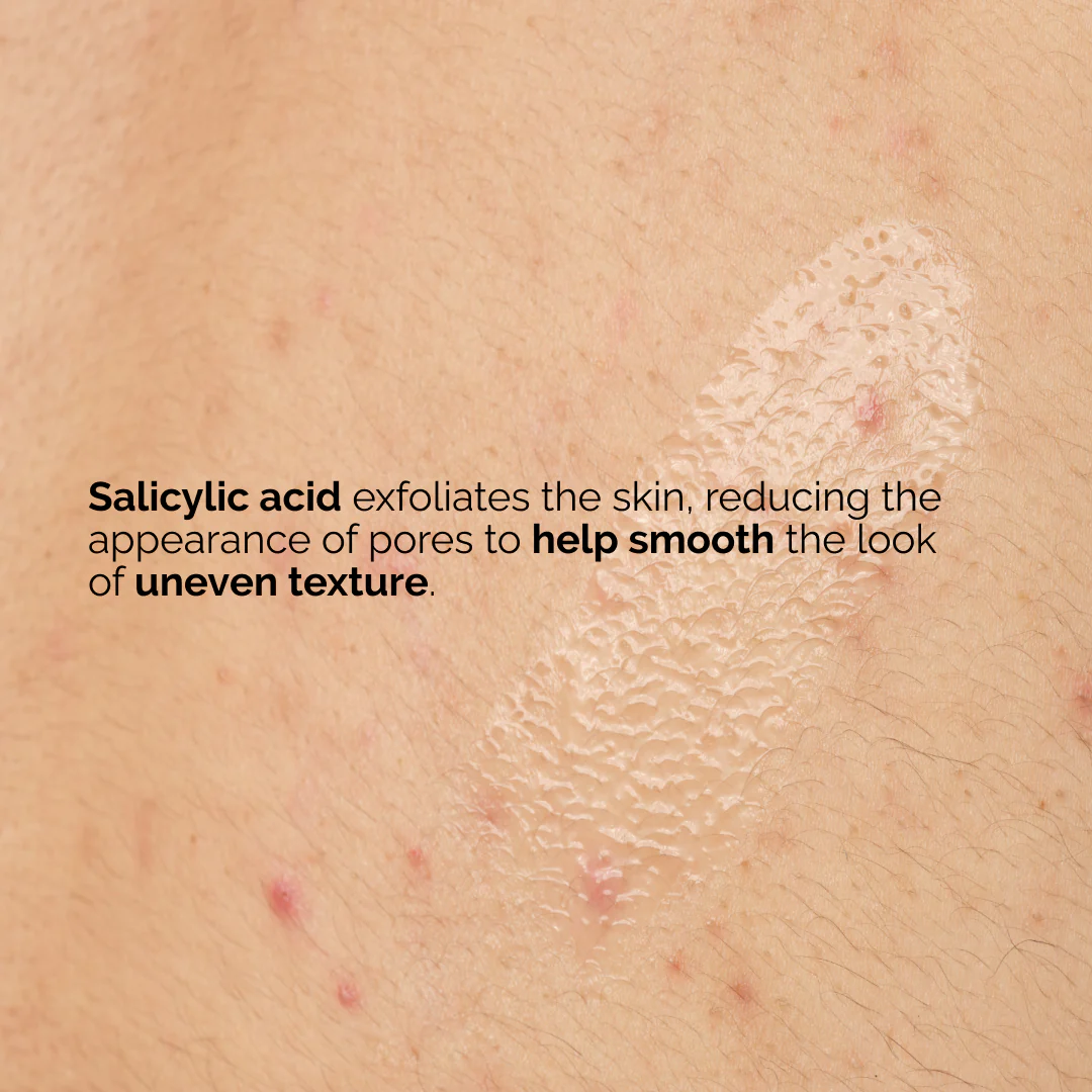 The Ordinary Salicylic Acid 0.5% Body Serum - Image 9