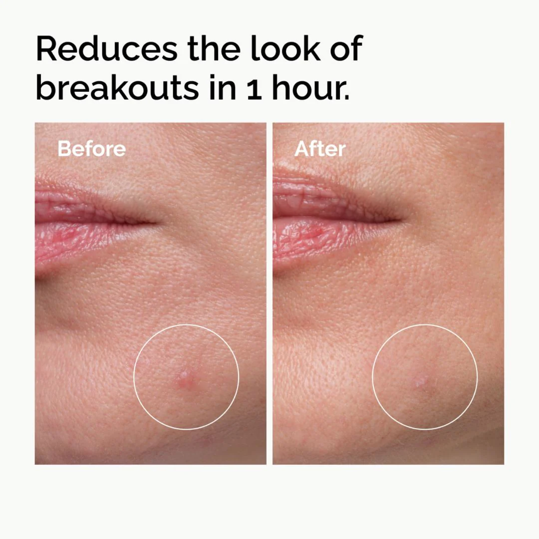 The Ordinary Sulfur 10% Powder-to-Cream Concentrate - Image 3
