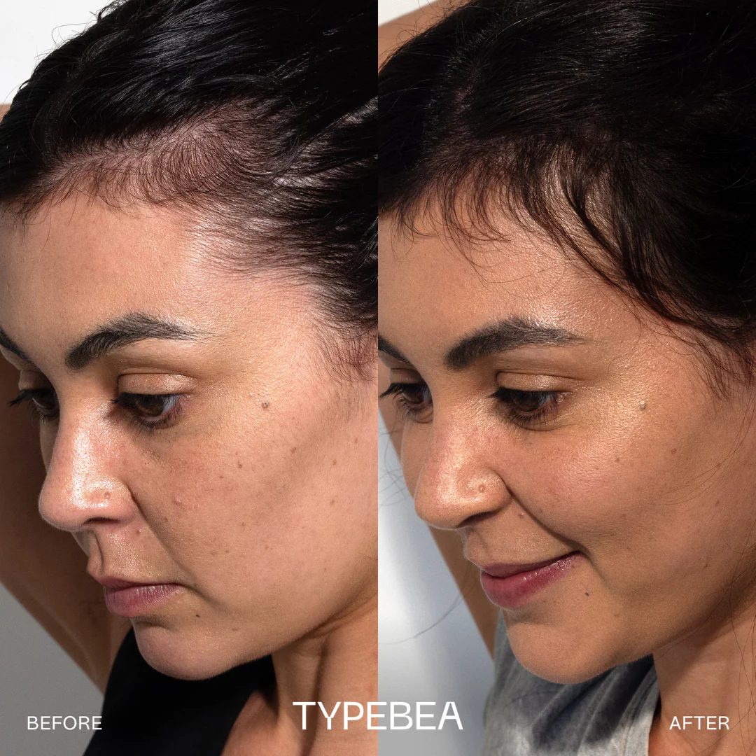 TYPEBEA G.1 Overnight Boosting Peptide Scalp Serum - Image 3