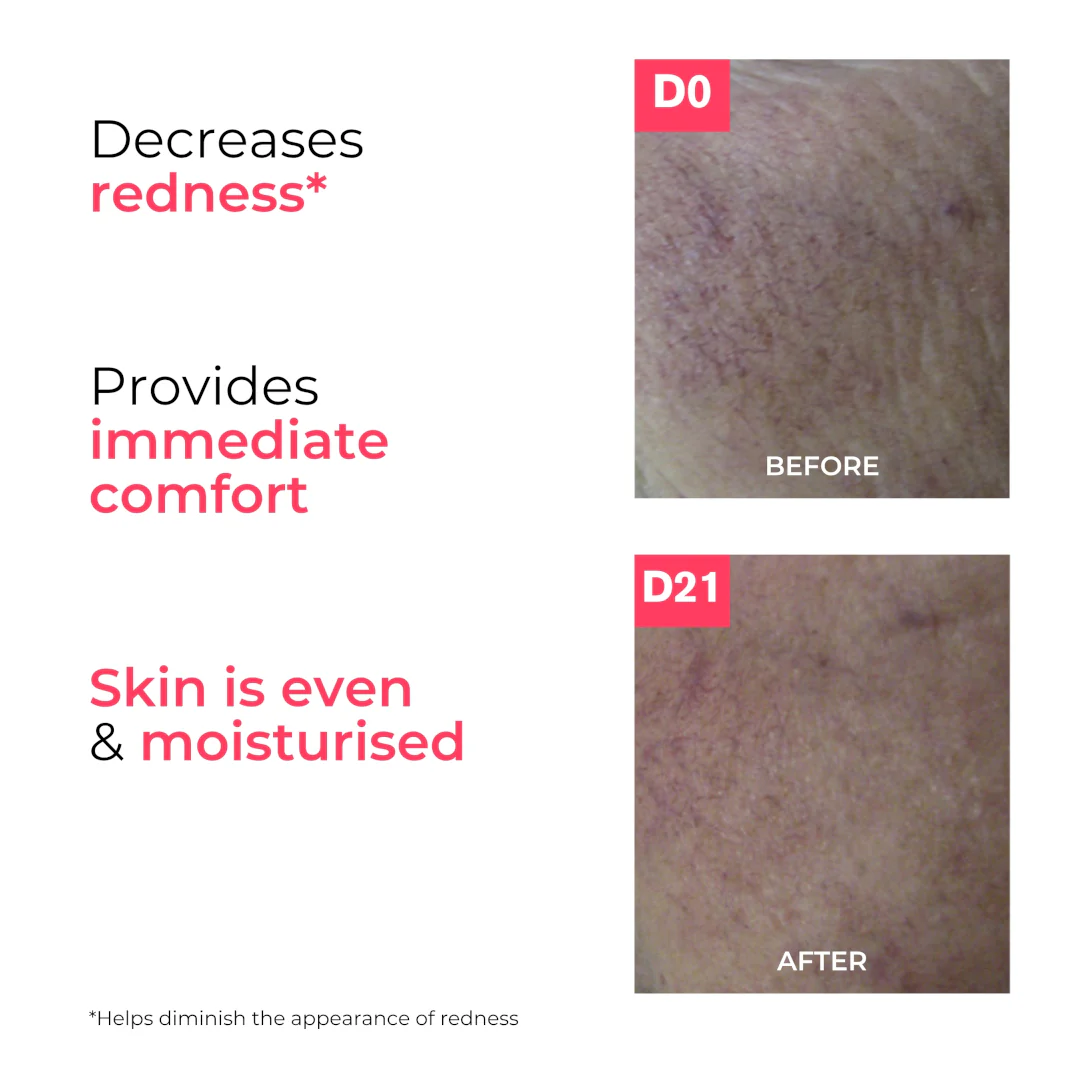 Uriage Roseliane Anti-Redness Cream - Image 6