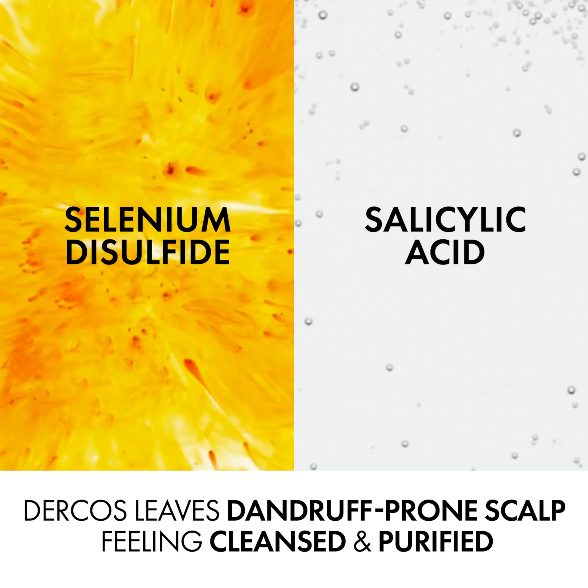 Vichy Dercos Anti-Dandruff Advanced Action Shampoo for Normal to Oily Hair - Image 5