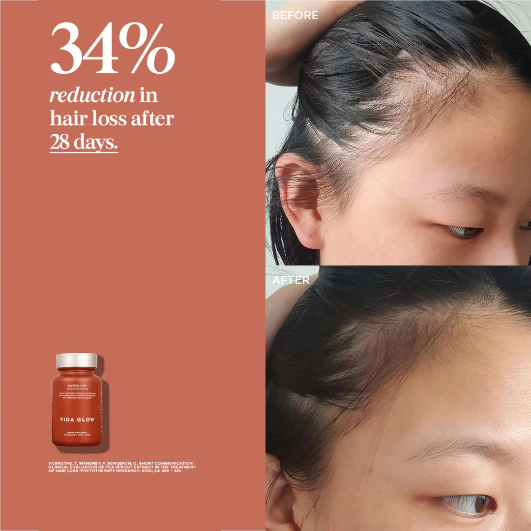 Vida Glow Advanced Repair Hairology 30 Capsules - Image 5
