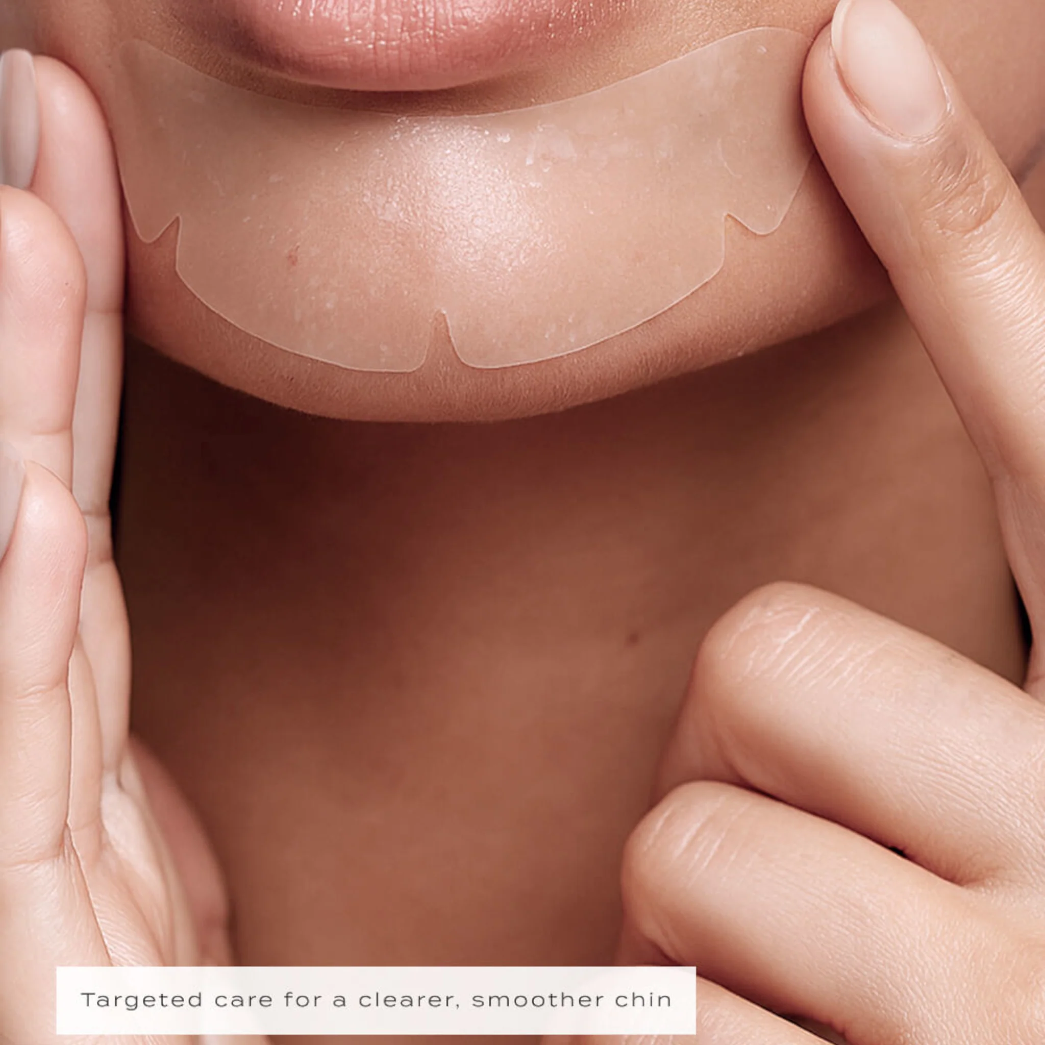 Vue Chin Patches - Image 2