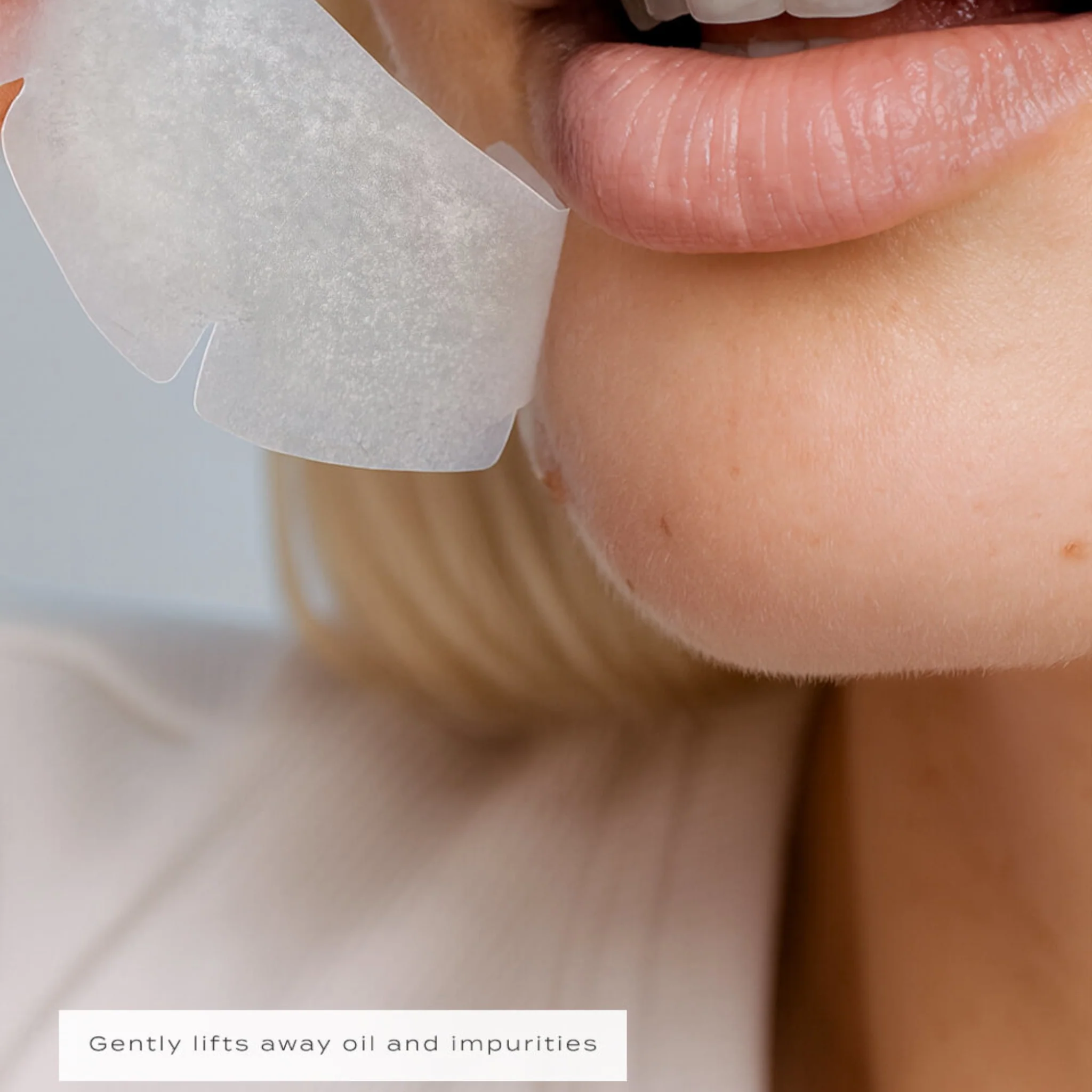 Vue Chin Patches - Image 3