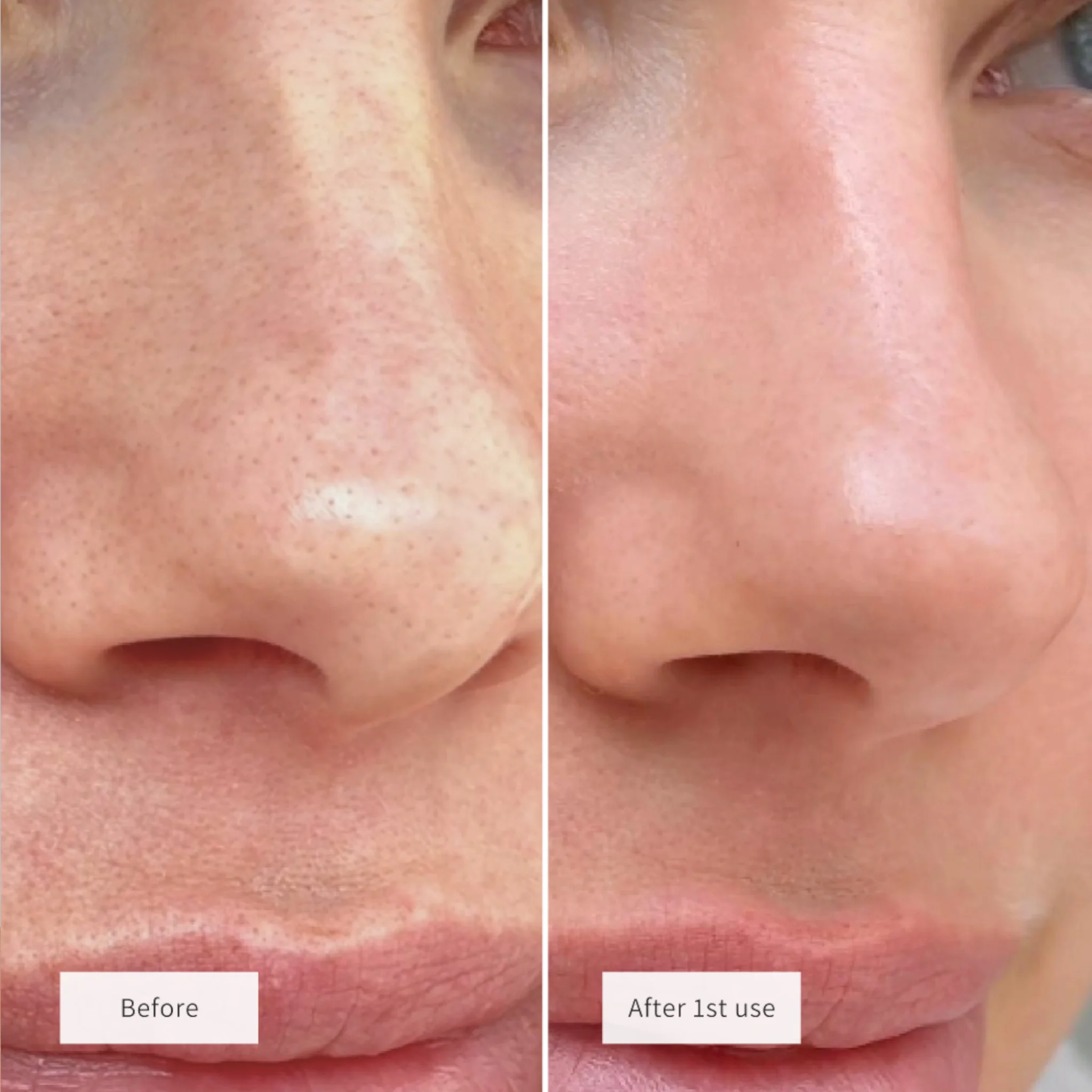 Vue Salicylic Acid Exfoliant - Image 5